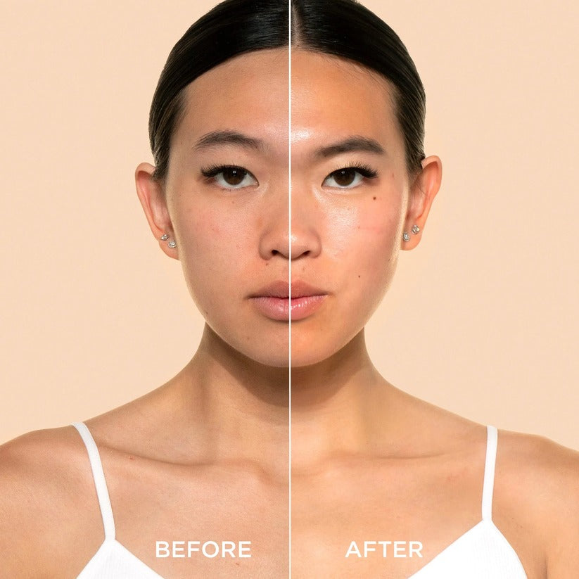 Gentle rice-based serum ampoule by Dr Melaxin for blackheads, acne, and pore refining