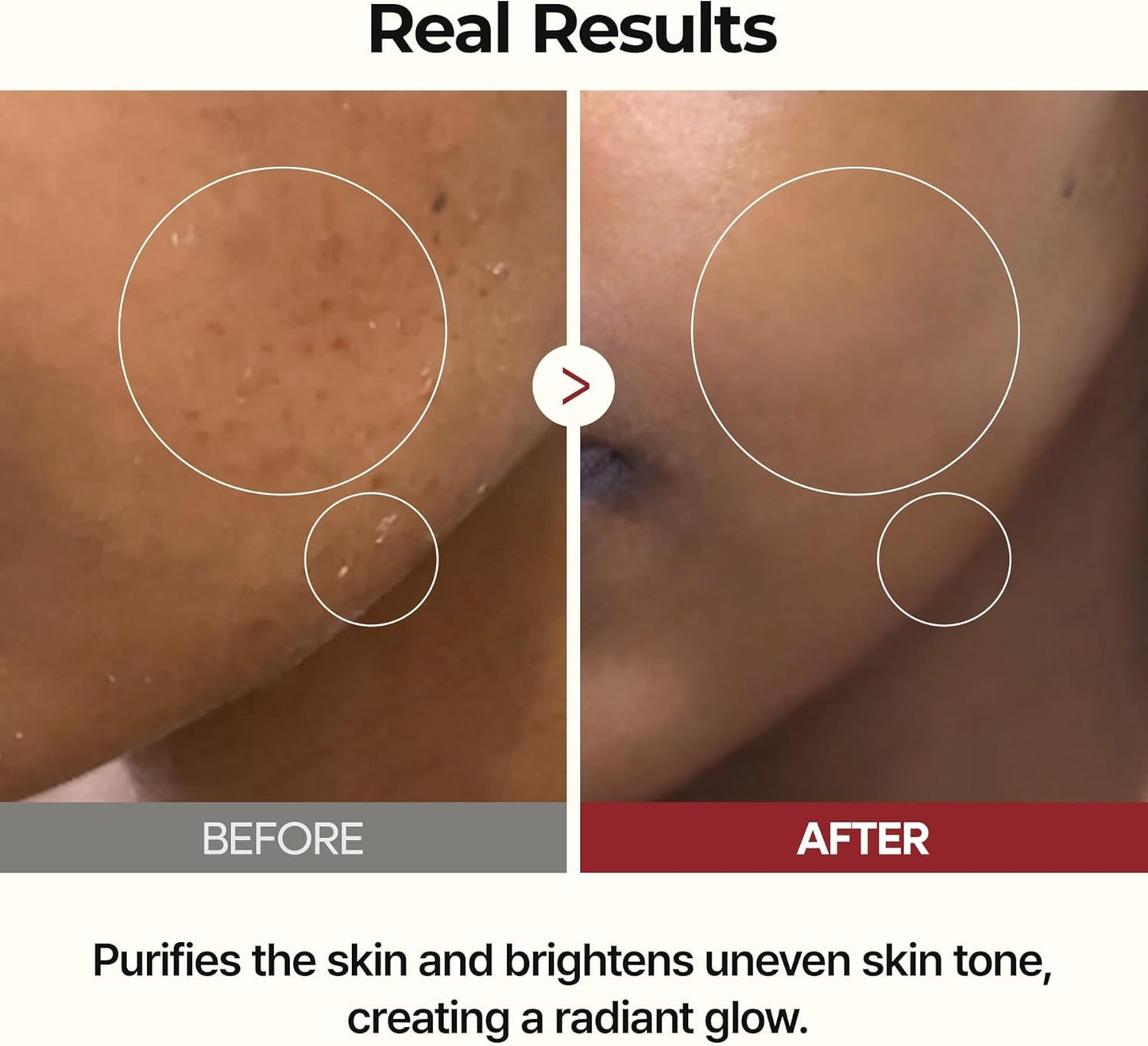Peel Shot Glow Rice Toner 200ml | Hydrating & Brightening Face Toner